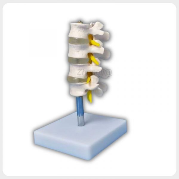 Lateral Disc Structure Lumbar Teaching Model Lateral view lumbar vertebra model showing intervertebral discs and nerve roots for orthopedic anatomy education