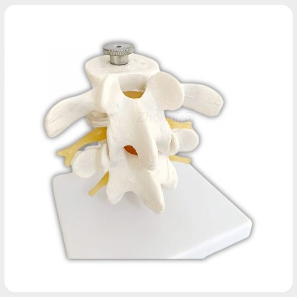 Adult Lumbar Spine Model with Detachable Discs Adult lumbar spine model with detachable intervertebral discs