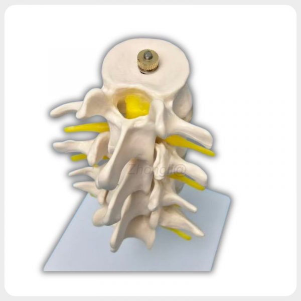 Superior Spinal Canal Lumbar Anatomy Model Superior oblique view lumbar spine model showing spinal canal vertebral arch and nerve roots for anatomy training