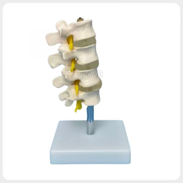 Oblique Disc Nerve Lumbar Spine Model Oblique lateral view lumbar spine model showing intervertebral discs nerve roots and vertebral processes for teaching
