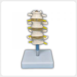 Anterior Vertebral Body Lumbar Teaching Model Anterior view lumbar spine model showing vertebral bodies intervertebral discs and nerve roots for medical education