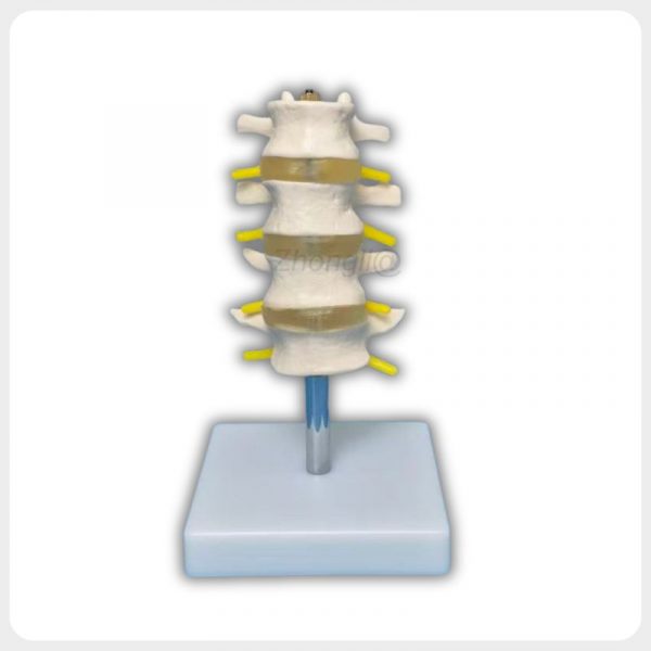 Anterior Vertebral Body Lumbar Teaching Model Anterior view lumbar spine model showing vertebral bodies intervertebral discs and nerve roots for medical education