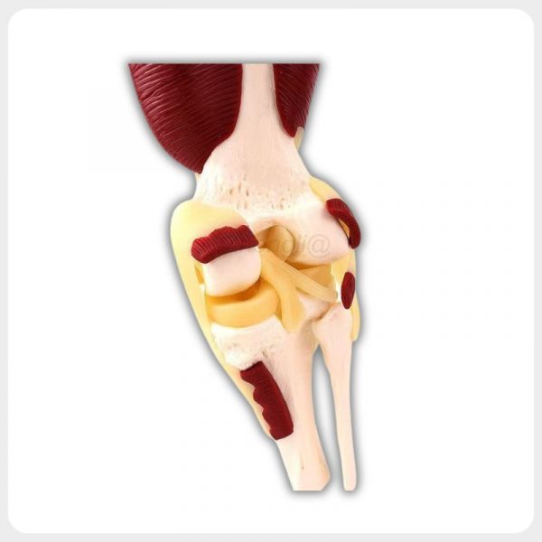 Knee Joint Deep Ligament Anatomy Model Anterior view of dissected knee anatomy exposing patella ligaments meniscus and femoral condyle for orthopedic education