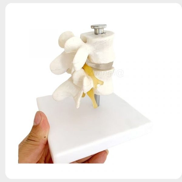 PVC Lumbar Spine Model for Medical Training Eco-friendly PVC lumbar spine model for medical training