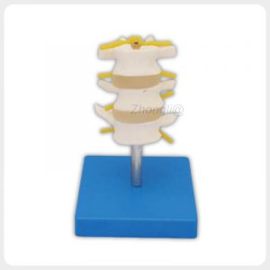 Three-Segment Lumbar Spine Model with Nerves Three-segment lumbar spine model with nerves and discs