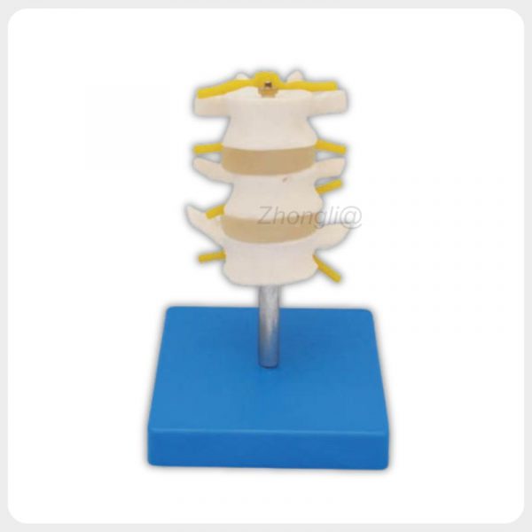 Three-Segment Lumbar Spine Model with Nerves Three-segment lumbar spine model with nerves and discs
