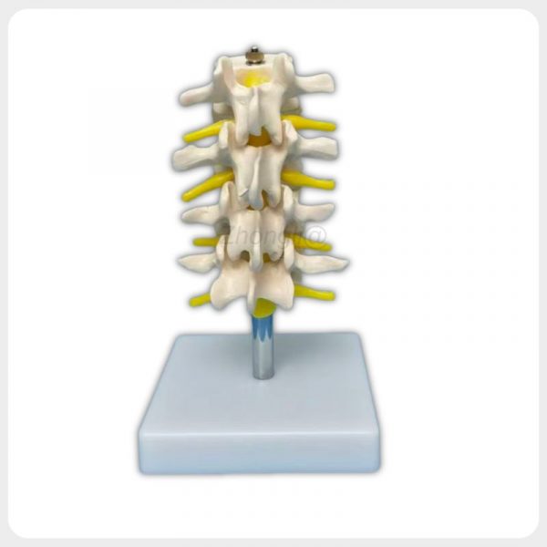 Posterior Nerve Root Lumbar Spine Model Posterior view lumbar spine model with visible spinous processes nerve roots and support stand for medical teaching