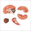Cerebrum Cerebellum Brainstem Anatomy Display Model Multi view brain anatomy set showing cerebrum cerebellum brainstem and cortical vessels used for comprehensive neuroscience education