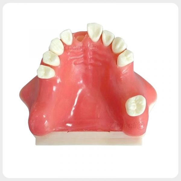 Maxillary sinus lift immediate implant training model with missing-tooth practice sites
