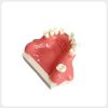Angled view of maxillary immediate implant practice model with simulated bone structure