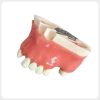 Resin maxillary implant training model with bottom metal mounting plate