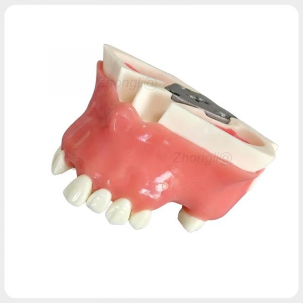 Resin maxillary implant training model with bottom metal mounting plate