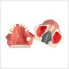 Maxillary sinus lift training model showing bilateral sinus cavities and mounting plate