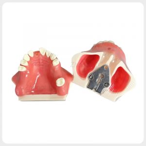 Bilateral Maxillary Sinus Training Model Maxillary sinus lift training model showing bilateral sinus cavities and mounting plate