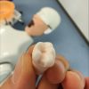 Class Two Cavity Preparation Replacement Tooth A removable resin training tooth positioned with a rubber dam clamp to demonstrate isolation techniques used in operative and restorative dentistry courses.