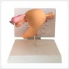 Female Reproductive Pathology Model Back View on Stand Female reproductive pathology model back view mounted on display stand