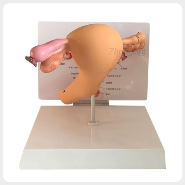 Female Reproductive Pathology Model Back View on Stand Female reproductive pathology model back view mounted on display stand