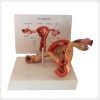 Female Reproductive Pathology Model Cutaway Side View Cutaway female reproductive pathology model with uterus and ovary lesions