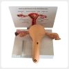 Female Reproductive Pathology Model Rear Structure Rear structure of female reproductive pathology model with support rod