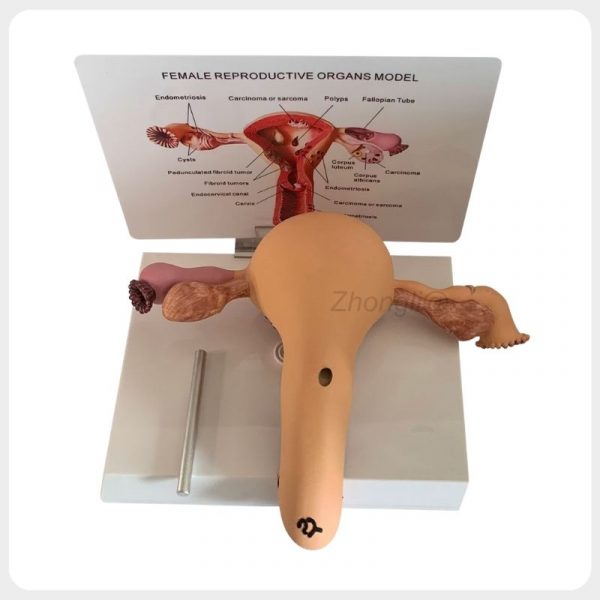 Female Reproductive Pathology Model Rear Structure Rear structure of female reproductive pathology model with support rod