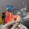 Phantom Head Operative Training with Replacement Teeth Dental handpiece cutting a resin replacement tooth beside a phantom head