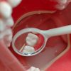 Replacement Tooth Indirect Mirror Vision Practice Dental mirror inspection of resin replacement tooth during typodont training