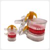lumbar-disc-herniation-model-anatomy Transparent lumbar disc herniation models with visible disc and nerve structures