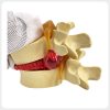 lumbar-disc-herniation-pathology-display Natural bone color lumbar disc model demonstrating herniation and nerve compression