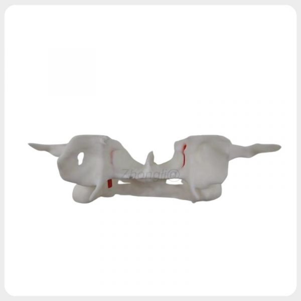 Pterygoid Implant Training Model Anatomy View Pterygoid implant training model showing maxillary anatomy and descending palatine artery
