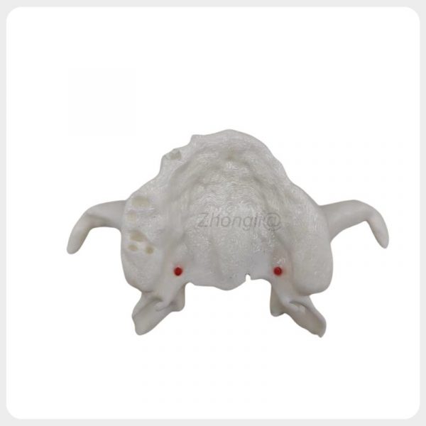 pterygoid_implant_training_model_superior_view.jpg Side view pterygoid implant training model with descending palatine artery anatomy