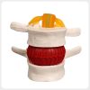 spine-disc-herniation-training-model Lumbar disc herniation training model showing simulated annulus structure