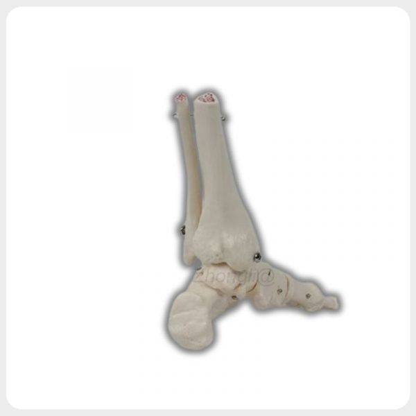 human ankle joint model showing tibia fibula and foot anatomy