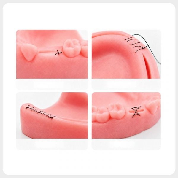 Four gingival suturing techniques demonstrated on dental model