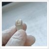 Prepared typodont tooth after dental cutting practice