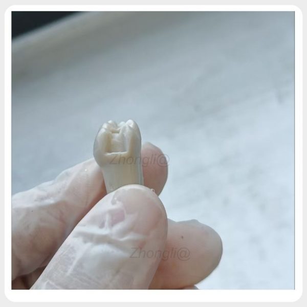 Prepared typodont tooth after dental cutting practice