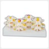 Lumbar Vertebrae Degeneration Comparison Model Posterior View Lumbar spine degeneration comparison model posterior view