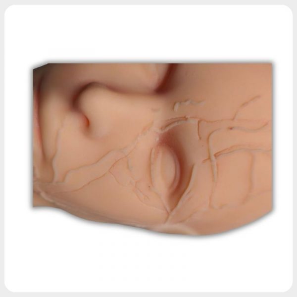 Periorbital Vascular Anatomy Injection Training Detail Close-up facial vascular anatomy around the eye for injection training