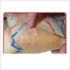Dermal Filler Injection Practice on Facial Training Model Facial injection training model for dermal filler needle practice