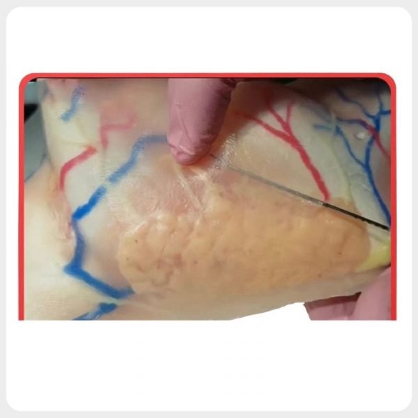 Dermal Filler Injection Practice on Facial Training Model Facial injection training model for dermal filler needle practice